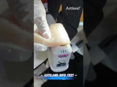 Kiểm tra năng lượng HIFU