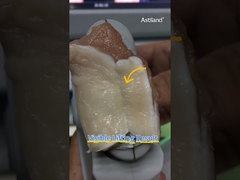 hãy kiểm tra hiệu ứng nâng ngay lập tức của HIFU