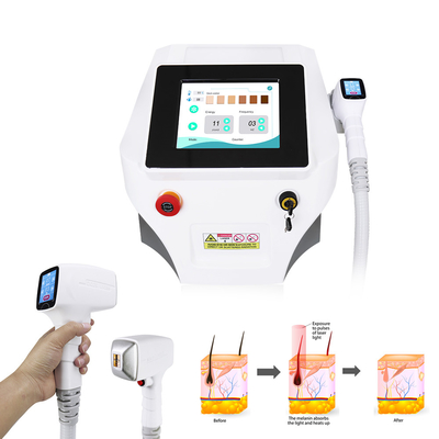 Triệt lông vĩnh viễn Máy Nova Ice Diode Laser 3 Wave 808nm